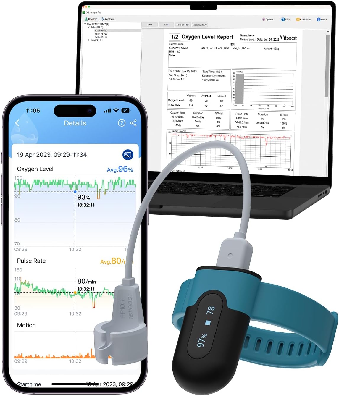Vibeat OxyU Wrist Pulse Oximeter – Bluetooth Blood Oxygen Monitor with Finger Sensor, Wearable Finger Oxygen Meter, Continuous Heart Rate & O2 Tracking, Real-time Notification, Free APP & PC Report